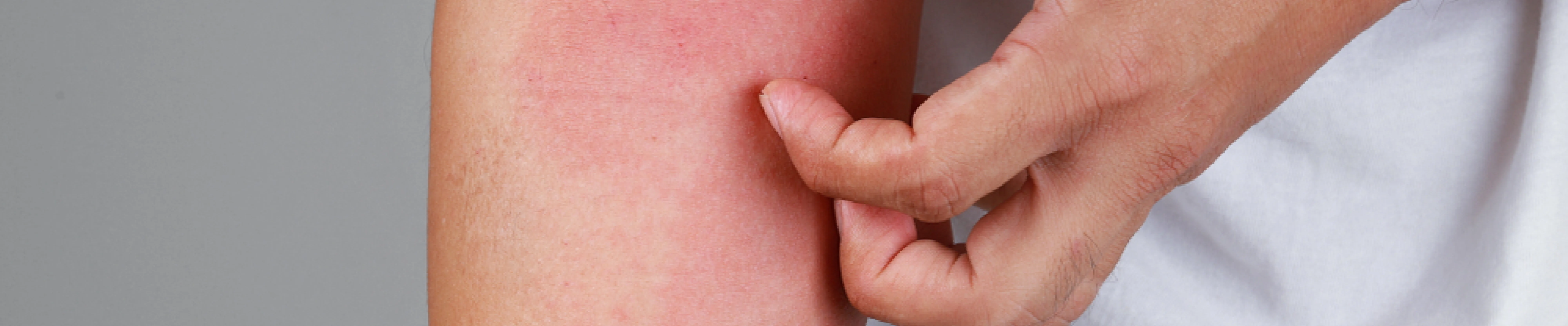 carpet cleaning in queens, carpet cleaning queens, carpet cleaners in queens, carpet cleaners in queens, commercial carpet cleaning, commercial carpet cleaning in queens, queens rug cleaners, rug cleaning services in queens, same day carpet cleaning, same day rug cleaning in queens